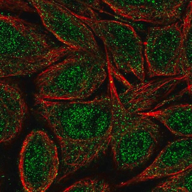 Anti-ZNF34 antibody produced in rabbit