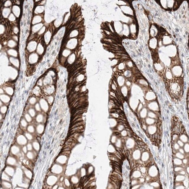 Anti-ZNF774 antibody produced in rabbit