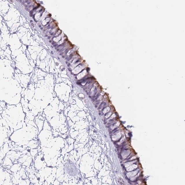Anti-ZNF239 antibody produced in rabbit