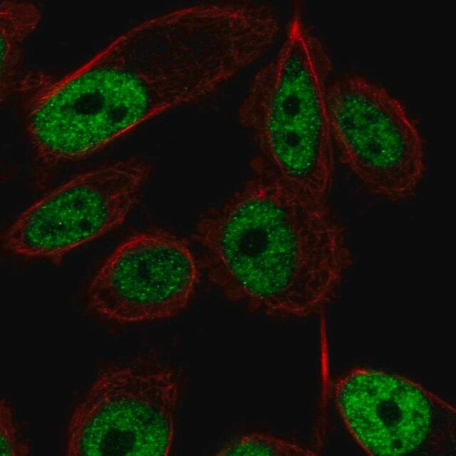 Anti-ZNF473 antibody produced in rabbit