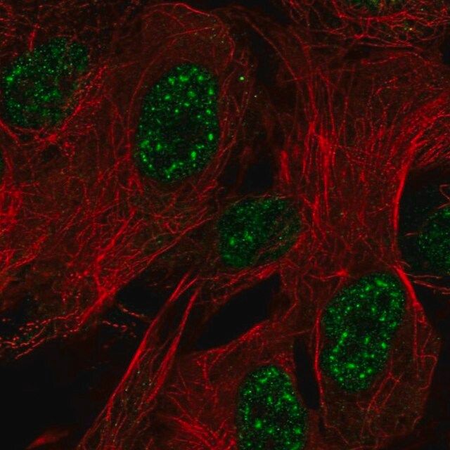 Anti-ZNF441 antibody produced in rabbit