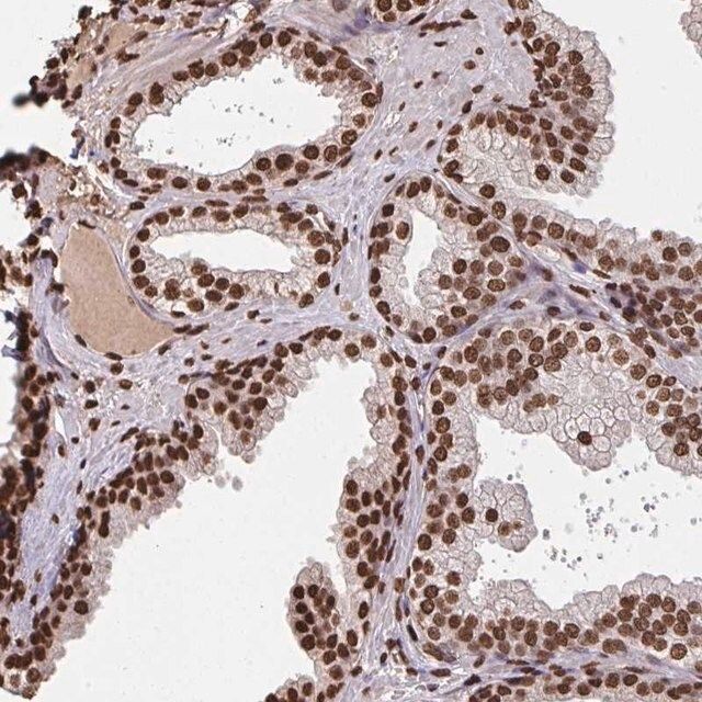 Anti-ZNF593 antibody produced in rabbit
