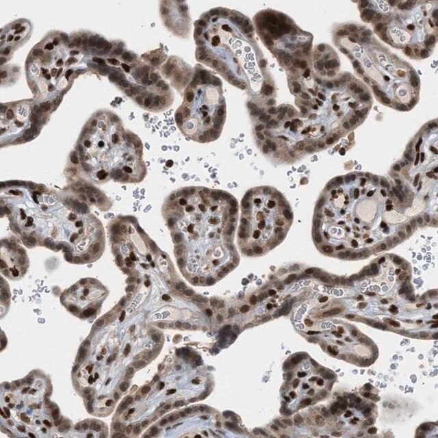 Anti-ZNF22 antibody produced in rabbit