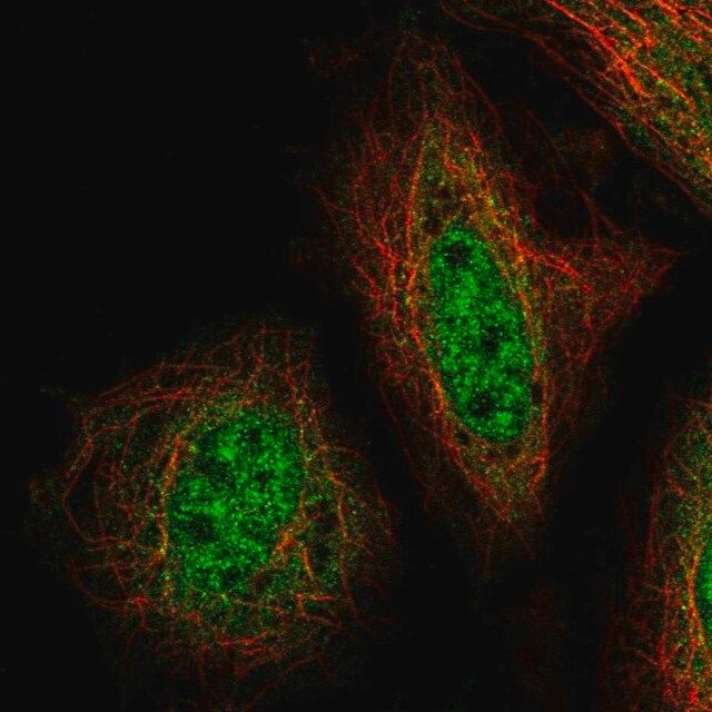 Anti-ZNF34 antibody produced in rabbit