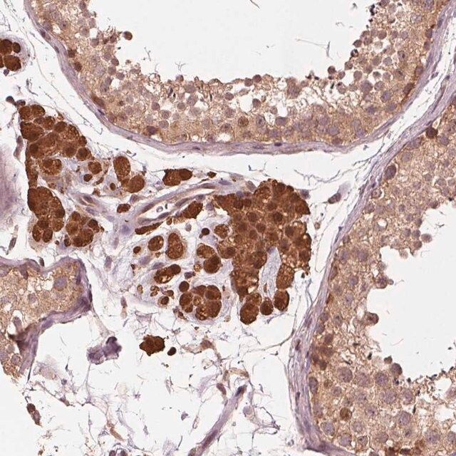 Anti-ZNF471 antibody produced in rabbit