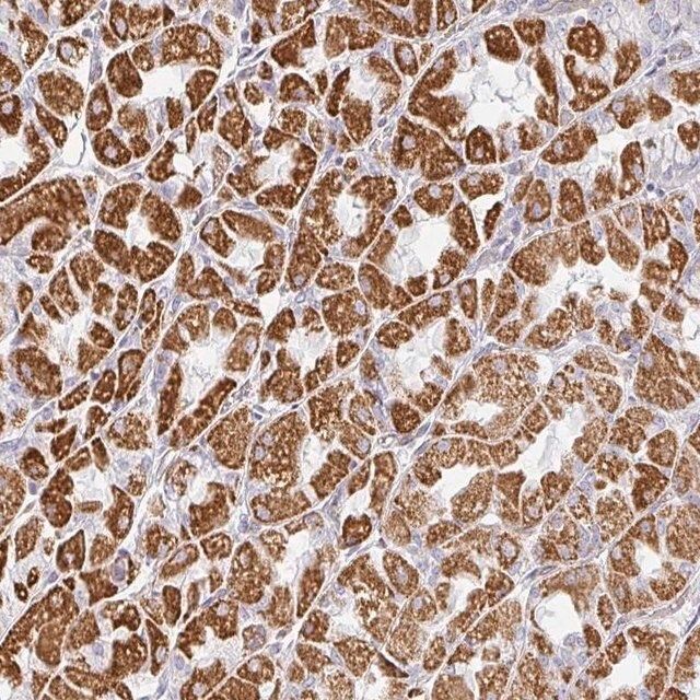 Anti-ZNF526 antibody produced in rabbit