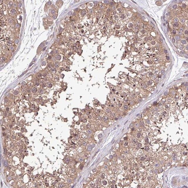 Anti-ZNF200 antibody produced in rabbit