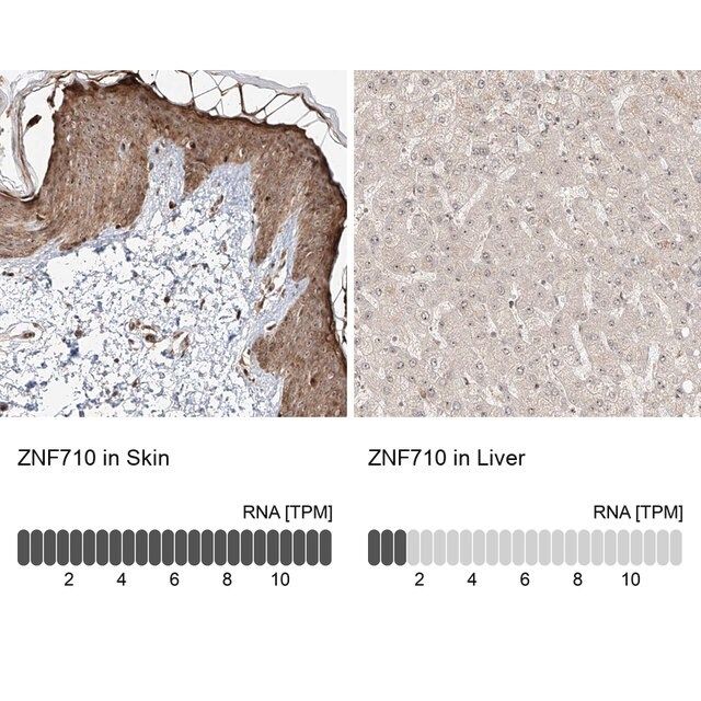 Anti-ZNF710 antibody produced in rabbit