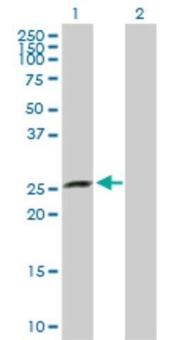 Anti-XRCC6BP1 antibody produced in rabbit