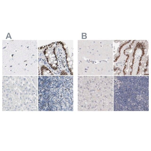 Anti-ZBTB7B antibody produced in rabbit