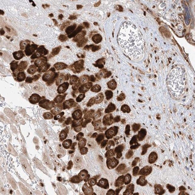 Anti-ZBTB8A antibody produced in rabbit