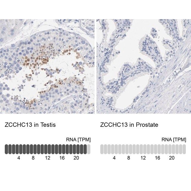 Anti-ZCCHC13 antibody produced in rabbit