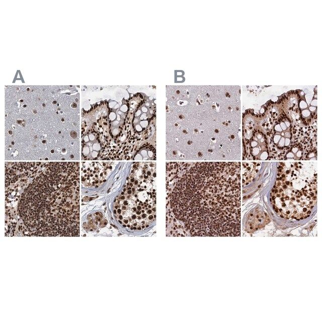 Anti-ZC3H18 antibody produced in rabbit