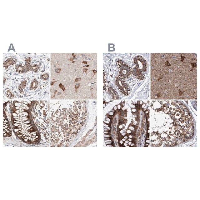 Anti-ZC3H15 antibody produced in rabbit