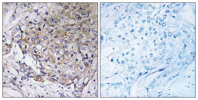 Anti-WASF3 antibody produced in rabbit