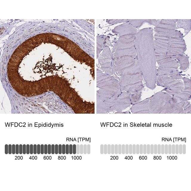 Anti-WFDC2 antibody produced in rabbit