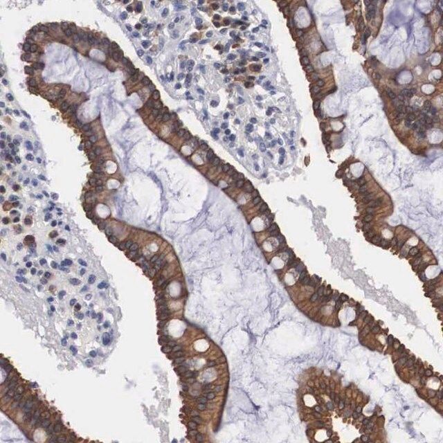 Anti-WDR89 antibody produced in rabbit