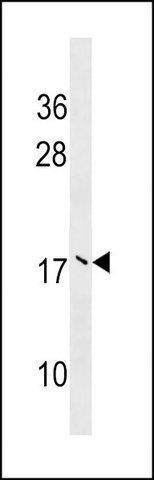 ANTI-UBE2V2 (CENTER) antibody produced in rabbit