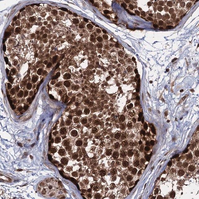 Anti-UBLCP1 antibody produced in rabbit