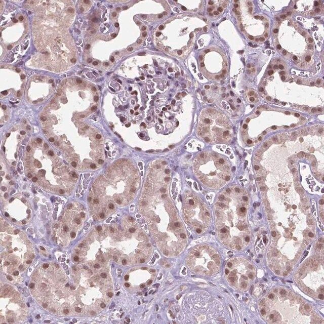 Anti-UBQLN4 antibody produced in rabbit