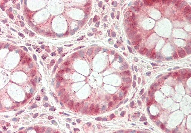 Anti-UCHL3 (C-terminal) antibody produced in rabbit
