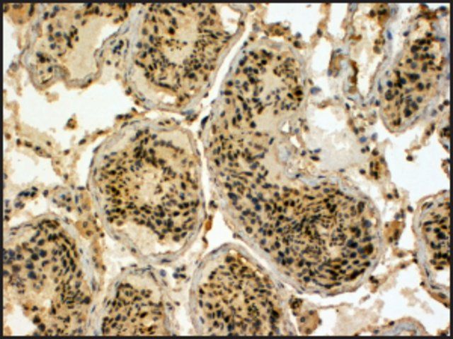 Anti-UBR5 (C-terminal) antibody produced in goat