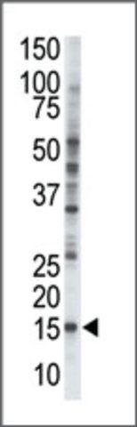 Anti-UBE2V1 (N-term) antibody produced in rabbit