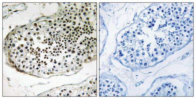 Anti-UBQLN3 antibody produced in rabbit