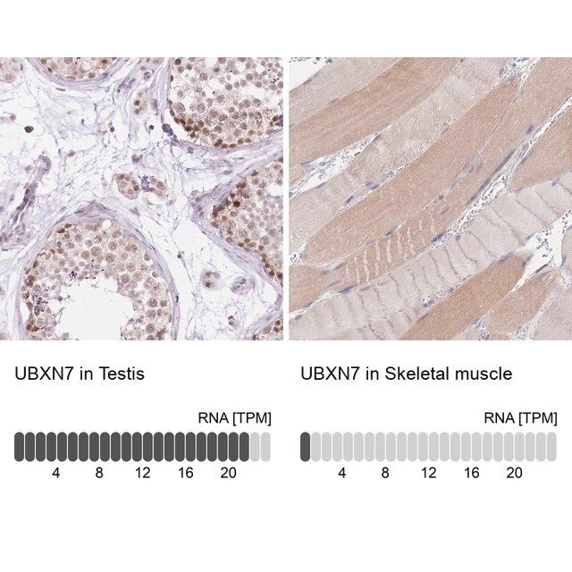 Anti-UBXN7 antibody produced in rabbit