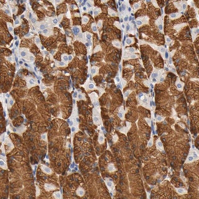 Anti-UCKL1 antibody produced in rabbit