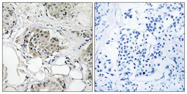 Anti-USP13 antibody produced in rabbit