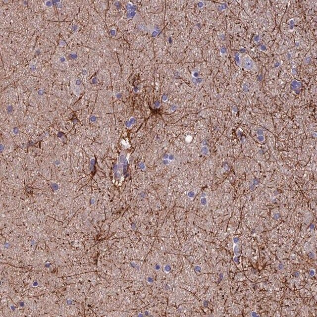Anti-USP37 antibody produced in rabbit