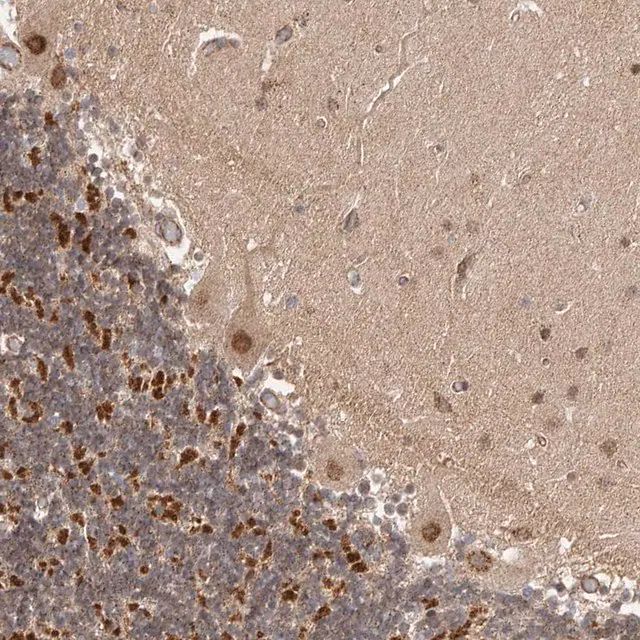 Anti-USP49 antibody produced in rabbit