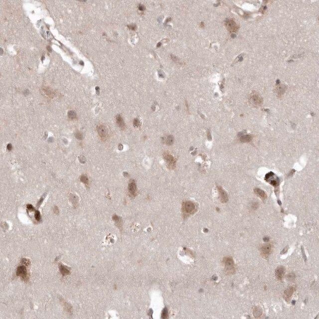 Anti-USP43 antibody produced in rabbit