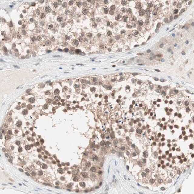 Anti-UBE2I antibody produced in rabbit
