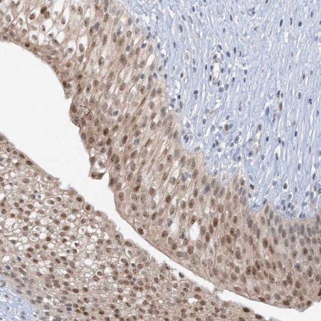 Anti-UBE2E1 antibody produced in rabbit