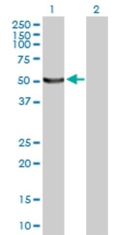 Anti-UBE1DC1 antibody produced in mouse