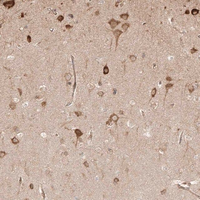Anti-UBE2K antibody produced in rabbit