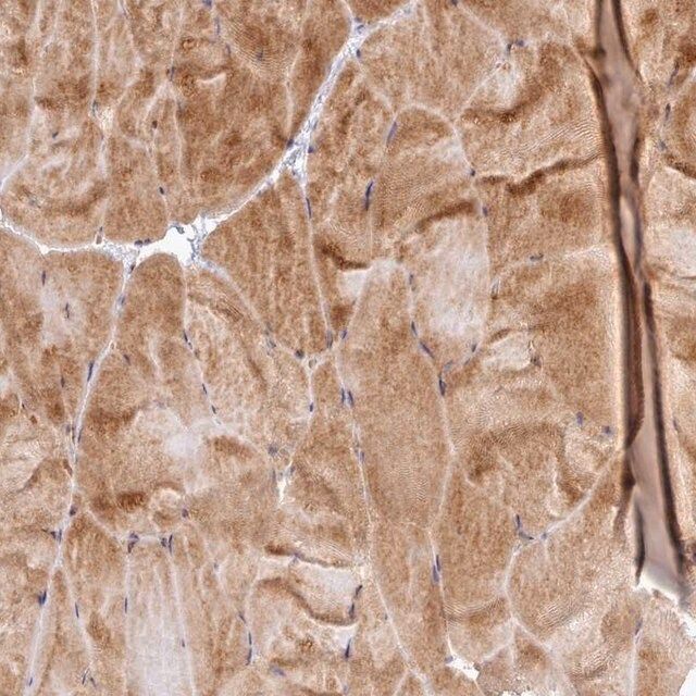 Anti-UBE2G1 antibody produced in rabbit