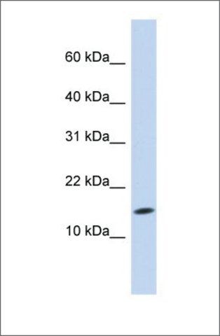 Anti-UBE2D3 antibody produced in rabbit