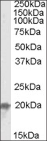 Anti-UBE2F (C-terminal) antibody produced in goat