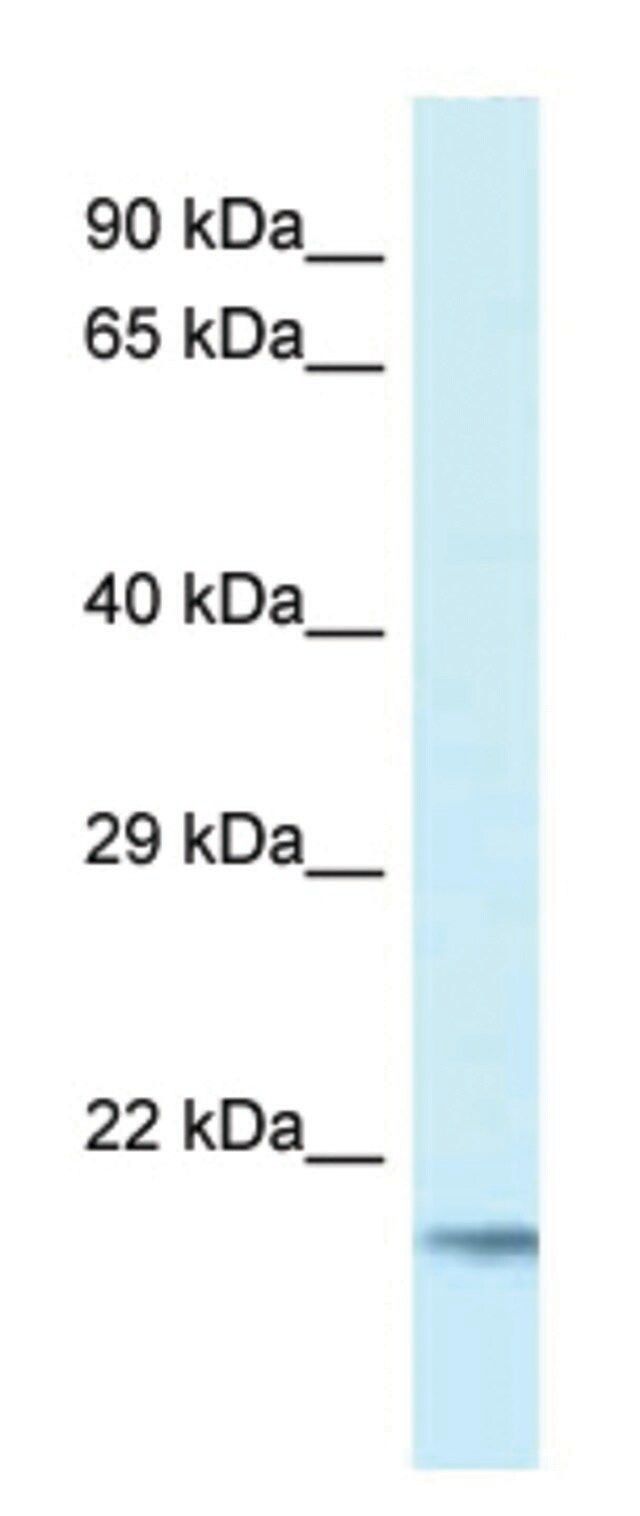 Anti-UBE2V1 (C-terminal) antibody produced in rabbit