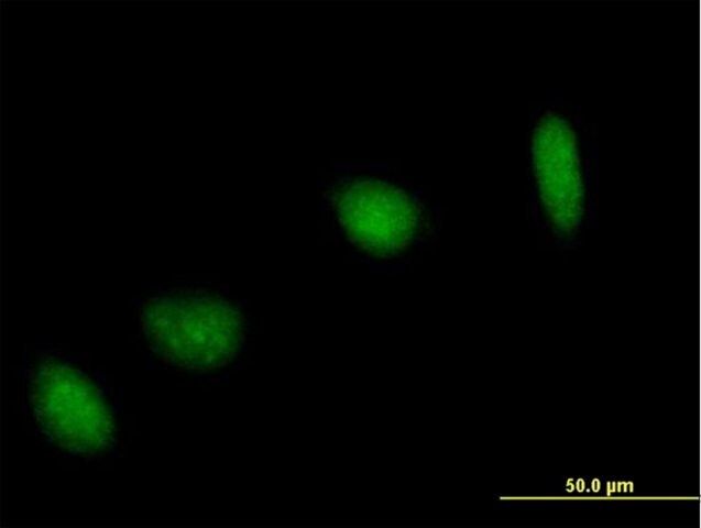 Anti-UBE2V1 antibody produced in mouse