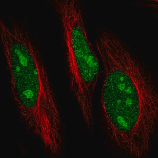 Anti-UBE2R2 antibody produced in rabbit