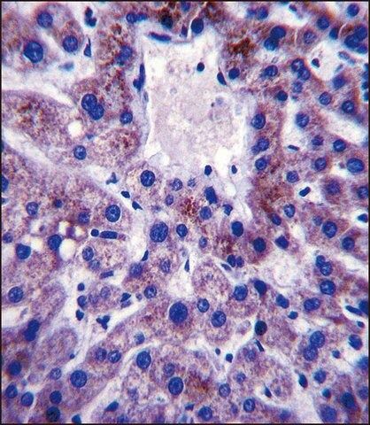 ANTI-UBE2W (C-TERM) antibody produced in rabbit