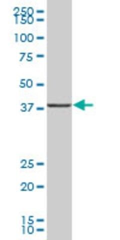 Anti-UBLCP1 antibody produced in mouse