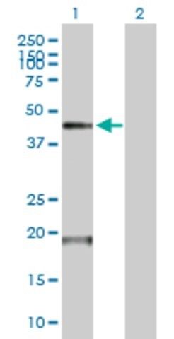 Anti-TMPRSS11D antibody produced in mouse