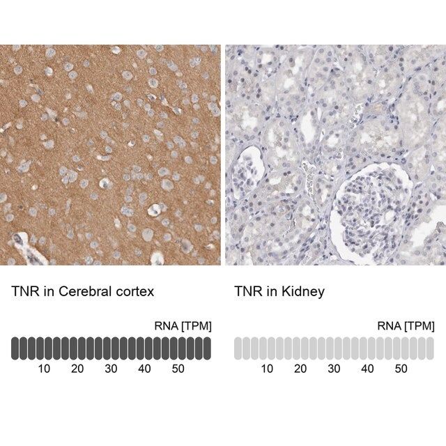 Anti-TNR antibody produced in rabbit