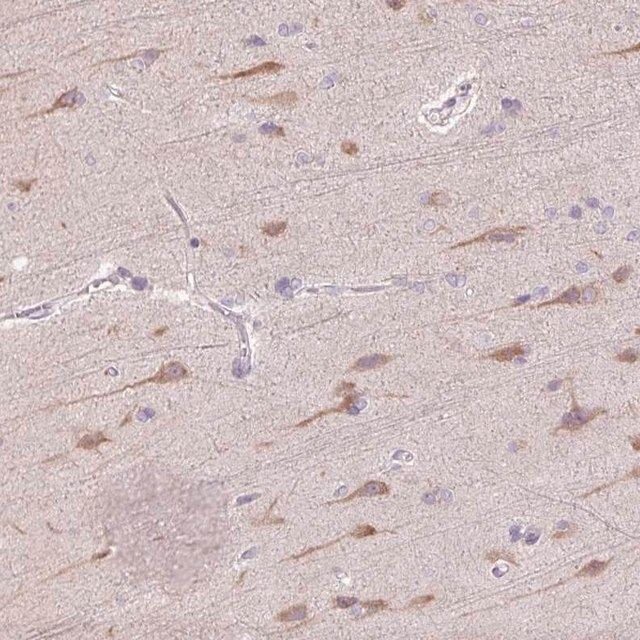 Anti-TMEM100 antibody produced in rabbit