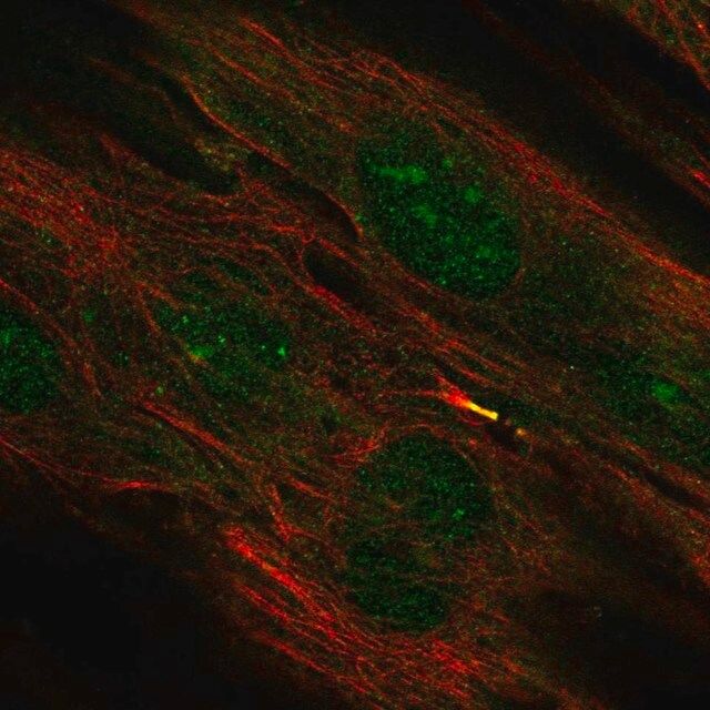 Anti-TMEM117 antibody produced in rabbit